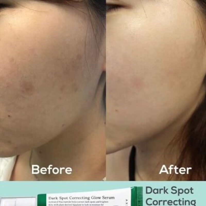Axis Y Dark Spot Correcting Glow Serum (Net Wt. 50ml) - Image 5