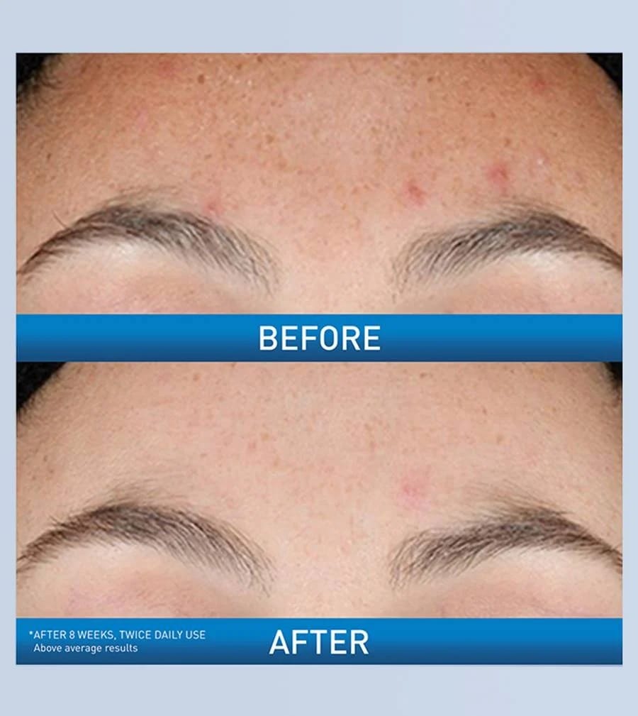 CeraVe Resurfacing Retinol Serum - (30ml) - Image 3