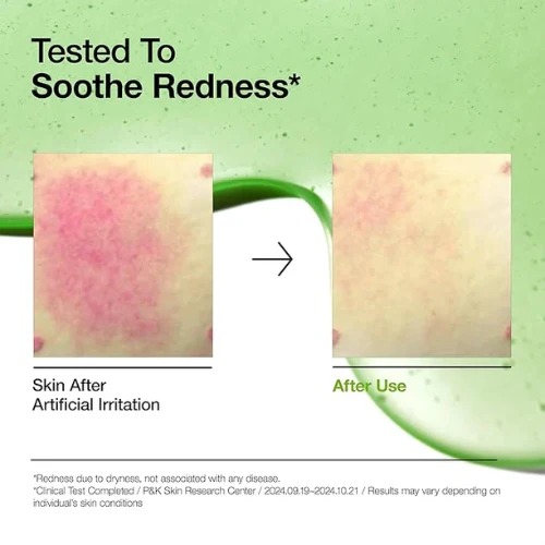 Anua Azelaic Acid 15+ Cica Intense Calming Serum - (30ml) - Image 2