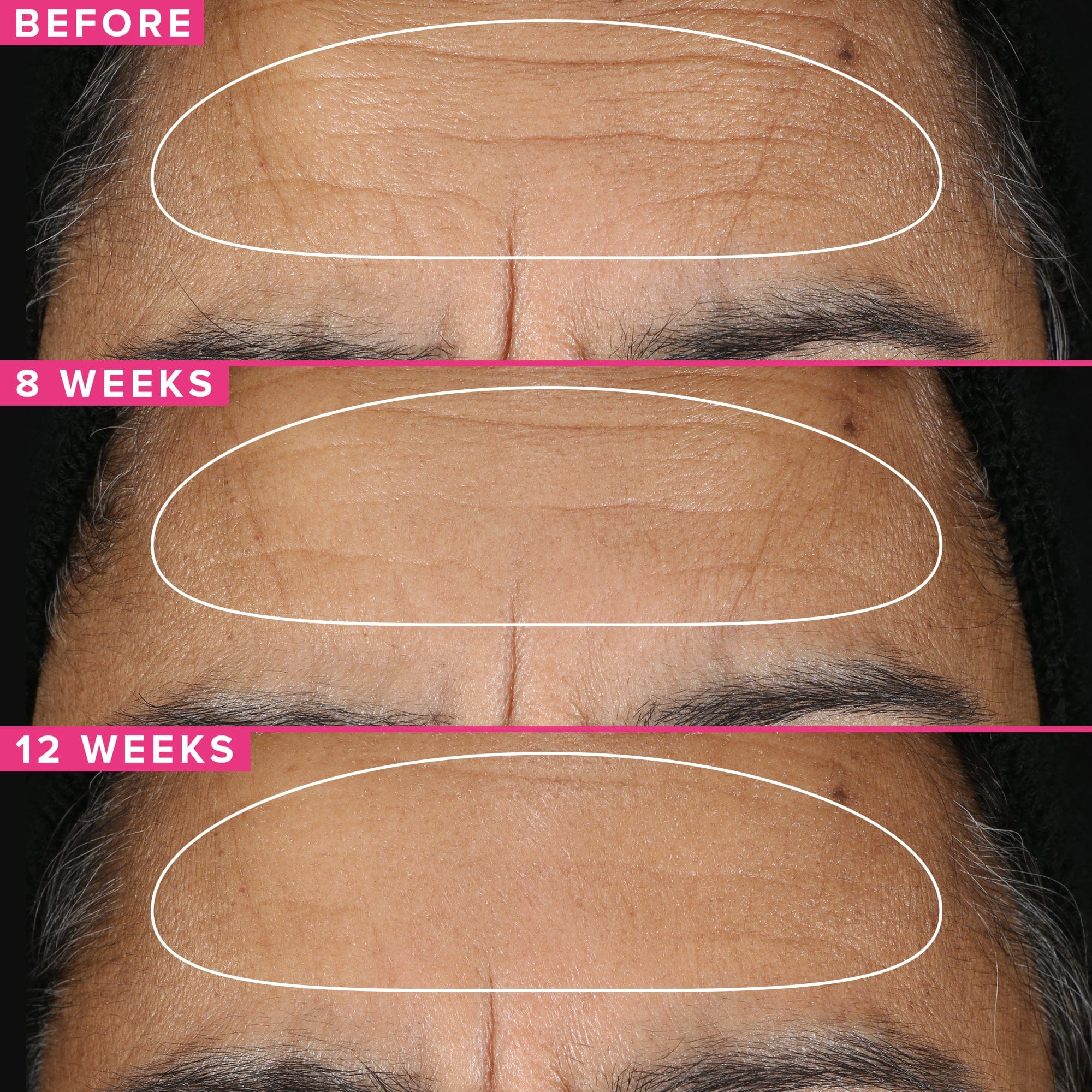 Farmacy Beauty 1% Vitamin A Retinol Serum - Image 4